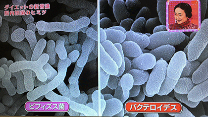 NHK ダイエットの新常識”ヤセ菌”のパワーって？これがカラダの新常識　若さと美の秘密#01